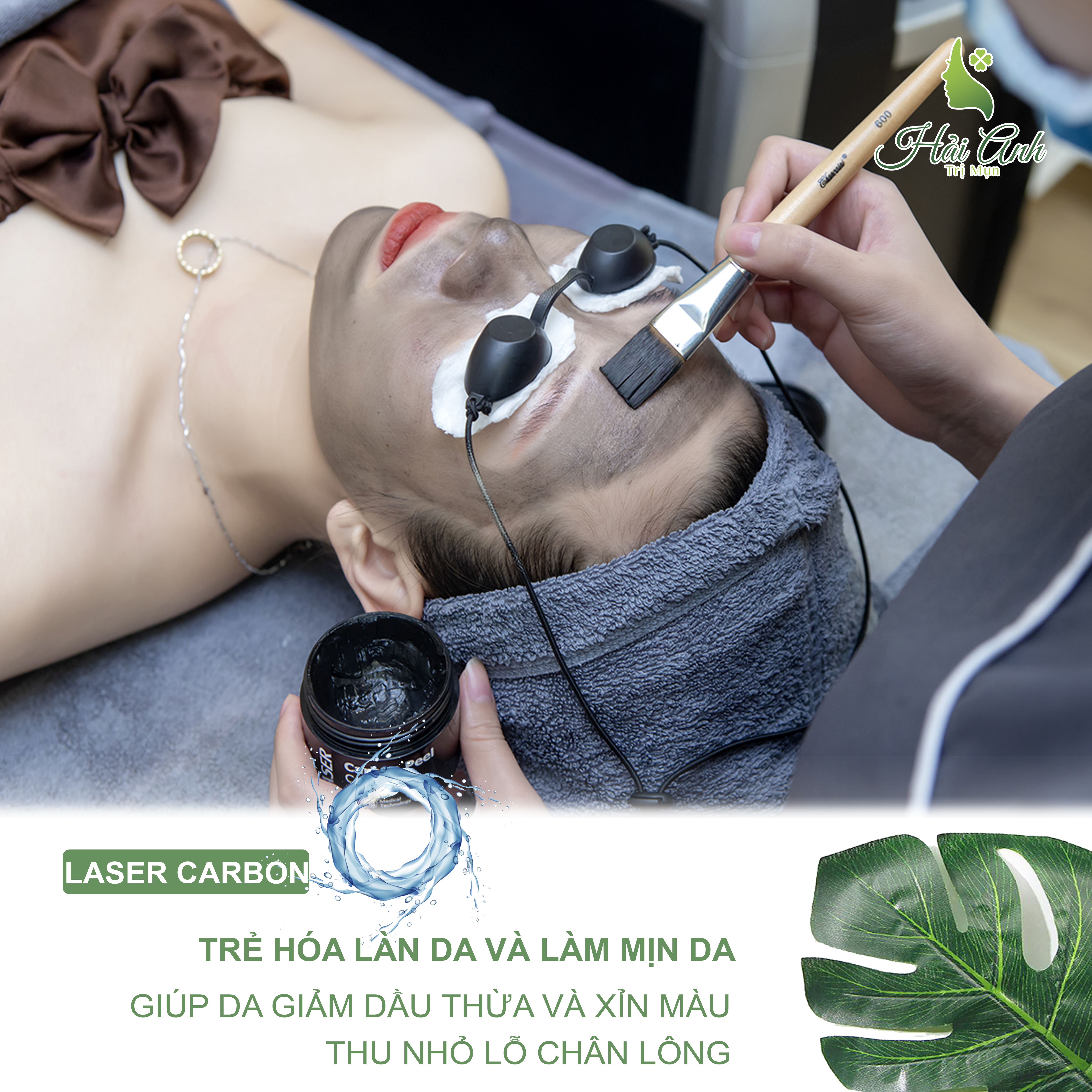 OFF 50% CHO LIỆU TRÌNH TÁI SINH LÀN DA ĐỔ DẦU, THÂM SẠM- LASER CARBON